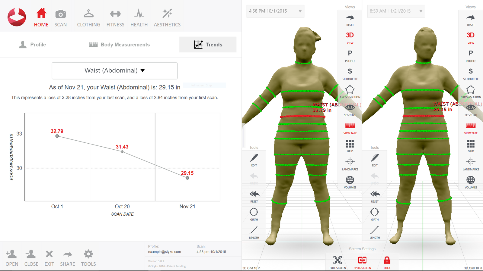 Styku 3D body scanning before and after comparison